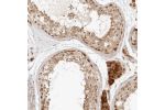 Immunohistochemical staining of human testis shows strong cytoplasmic positivity in Leydig cells, as well as moderate cytoplasmic and nuclear positivity in cells in seminiferous ducts.