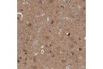 Immunohistochemical staining of human cerebral cortex shows moderate cytoplasmic positivity in a subset of neurons.