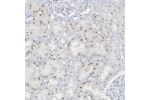 Immunohistochemical staining of human kidney shows moderate nuclear positivity in cells in tubules.