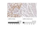 Immunohistochemistry analysis in human kidney and heart muscle tissues using Anti-LAMP2 antibody. Corresponding LAMP2 RNA-seq data are presented for the same tissues.
