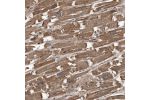 Immunohistochemical staining of human heart muscle shows strong cytoplasmic positivity in cardiomyocytes.
