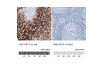 Immunohistochemistry analysis in human liver and tonsil tissues using HPA029125 antibody. Corresponding HSD17B13 RNA-seq data are presented for the same tissues.