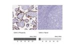 Immunohistochemistry analysis in human placenta and tonsil tissues using HPA029126 antibody. Corresponding GAA RNA-seq data are presented for the same tissues.
