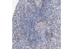 Immunohistochemical staining of human spleen shows moderate membranous positivity in cells in white pulp.
