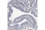 Immunohistochemical staining of human fallopian tube shows moderate nuclear positivity in a subset of glandular cells.