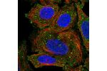 Immunofluorescent staining of human cell line SiHa shows localization to plasma membrane & cytoplasmic bodies.