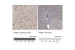 Immunohistochemistry analysis in human cerebral cortex and pancreas tissues using Anti-PON2 antibody. Corresponding PON2 RNA-seq data are presented for the same tissues.