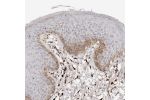 Immunohistochemical staining of human vulva/anal skin shows moderate cytoplasmic positivity in epidermal cells.