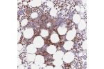 Immunohistochemical staining of human bone marrow shows strong cytoplasmic positivity in hematopoietic cells.