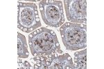 Immunohistochemical staining of human small intestine shows strong cytoplasmic positivity in lymphoid cells.