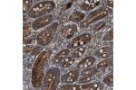 Immunohistochemical staining of human duodenum shows strong cytoplasmic positivity in glandular cells.