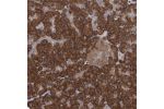 Immunohistochemical staining of human pancreas shows strong cytoplasmic positivity in exocrine glandular cells.