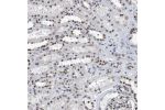 Immunohistochemical staining of human Kidney shows moderate nuclear positivity in cells in glomeruli and tubules.