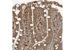 Immunohistochemical staining of human duodenum shows moderate cytoplasmic positivity in glandular cells.