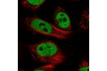 Immunofluorescent staining of human cell line U-251 MG shows localization to nucleoplasm.