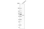 Western blot analysis in human cell line SK-MEL-30.