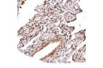 Immunohistochemical staining of human colon shows strong cytoplasmic positivity in glandular cells.