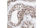 Immunohistochemical staining of human testis shows strong nuclear positivity in cells in seminiferous ducts.