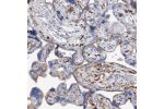 Immunohistochemical staining of human placenta shows membranous positivity in trophoblastic cells.