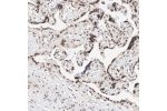 Immunohistochemical staining of human placenta shows strong nuclear positivity in trophoblastic cells.