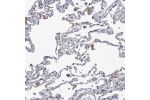Immunohistochemical staining of human lung shows moderate cytoplasmic positivity in macrophages.