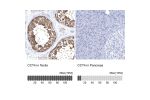 Immunohistochemistry analysis in human testis and pancreas tissues using Anti-CCT4 antibody. Corresponding CCT4 RNA-seq data are presented for the same tissues.