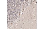 Immunohistochemical staining of human cerebellum shows moderate nuclear positivity in Purkinje cells.