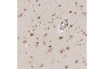 Immunohistochemical staining of human cerebral cortex shows moderate nuclear positivity in neuronal cells.