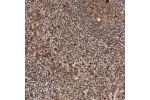 Immunohistochemical staining of human spleen shows strong cytoplasmic positivity in cells in red pulp.