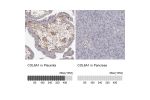 Immunohistochemistry analysis in human placenta and pancreas tissues using HPA029401 antibody. Corresponding COL6A1 RNA-seq data are presented for the same tissues.