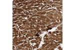 Immunohistochemical staining of human heart muscle shows strong cytoplasmic positivity in myocytes.