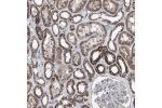Immunohistochemical staining of human duodenum shows strong cytoplasmic positivity with a granular pattern in glandular cells.