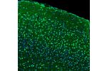 Immunofluorescence staining of human cerebral cortex shows strong positivity of neurons in the visual cortex.