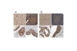 Immunohistochemical staining of human cerebral cortex, lymph node, testis and urinary bladder using Anti-CCT8 antibody HPA029426 (A) shows similar protein distribution across tissues to independent antibody HPA018520 (B).