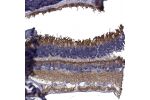 Immunohistochemical staining of human eye shows strong cytoplasmic positivity in photoreceptor cells.