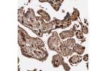Immunohistochemical staining of human placenta shows strong cytoplasmic positivity in trophoblastic cells.