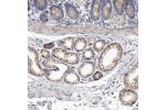 Immunohistochemical staining of human duodenum shows moderate membranous positivity in glandular cells.