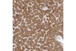 Immunohistochemical staining of human liver shows cytoplasmic positivity in hepatocytes.