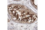 Immunohistochemical staining of human testis shows strong cytoplasmic positivity in subset of cells in seminiferus ducts.