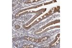 Immunohistochemical staining of human duodenum shows moderate cytoplasmic positivity in glandular cells.