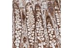 Immunohistochemical staining of human rectum shows strong cytoplasmic positivity in glandular cells.