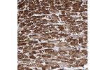 Immunohistochemical staining of human heart muscle shows strong cytoplasmic positivity.