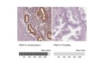 Immunohistochemistry analysis in human endometrium and prostate tissues using HPA029473 antibody. Corresponding PAEP RNA-seq data are presented for the same tissues.