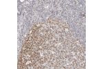 Immunohistochemical staining of human vulva/anal skin shows strong nuclear positivity in squamous epithelial cells.