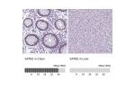Immunohistochemistry analysis in human colon and liver tissues using HPA029543 antibody. Corresponding SATB2 RNA-seq data are presented for the same tissues.