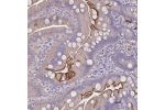 Immunohistochemical staining of human small intestine shows strong luminal membranous positivity in glandular cells.