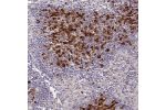 Immunohistochemical staining of human lymph node shows strong membranous and cytoplasmic positivity in germinal and non-germinal center cells.
