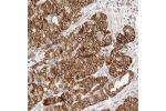 Immunohistochemical staining of human stomach shows strong membranous and cytoplasmic positivity in glandular cells.