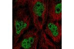 Immunofluorescent staining of human cell line CACO-2 shows localization to nucleoplasm.
