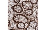 Immunohistochemical staining of human rectum shows strong cytoplasmic and nuclear positivity in glandular cells.
